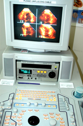Ecocardio Color Doppler